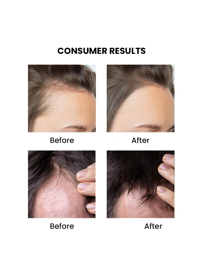 ثريفيكو زيت إكليل الجبل والنعناع من ثرايف كو | لنمو الشعر والحد من تساقطه والتحكم في قشرة الرأس | ينعم فروة الرأس الجافة ويصلح الأطراف المتقصفة | مناسب للرجال والنساء | 50 مل - Image 2